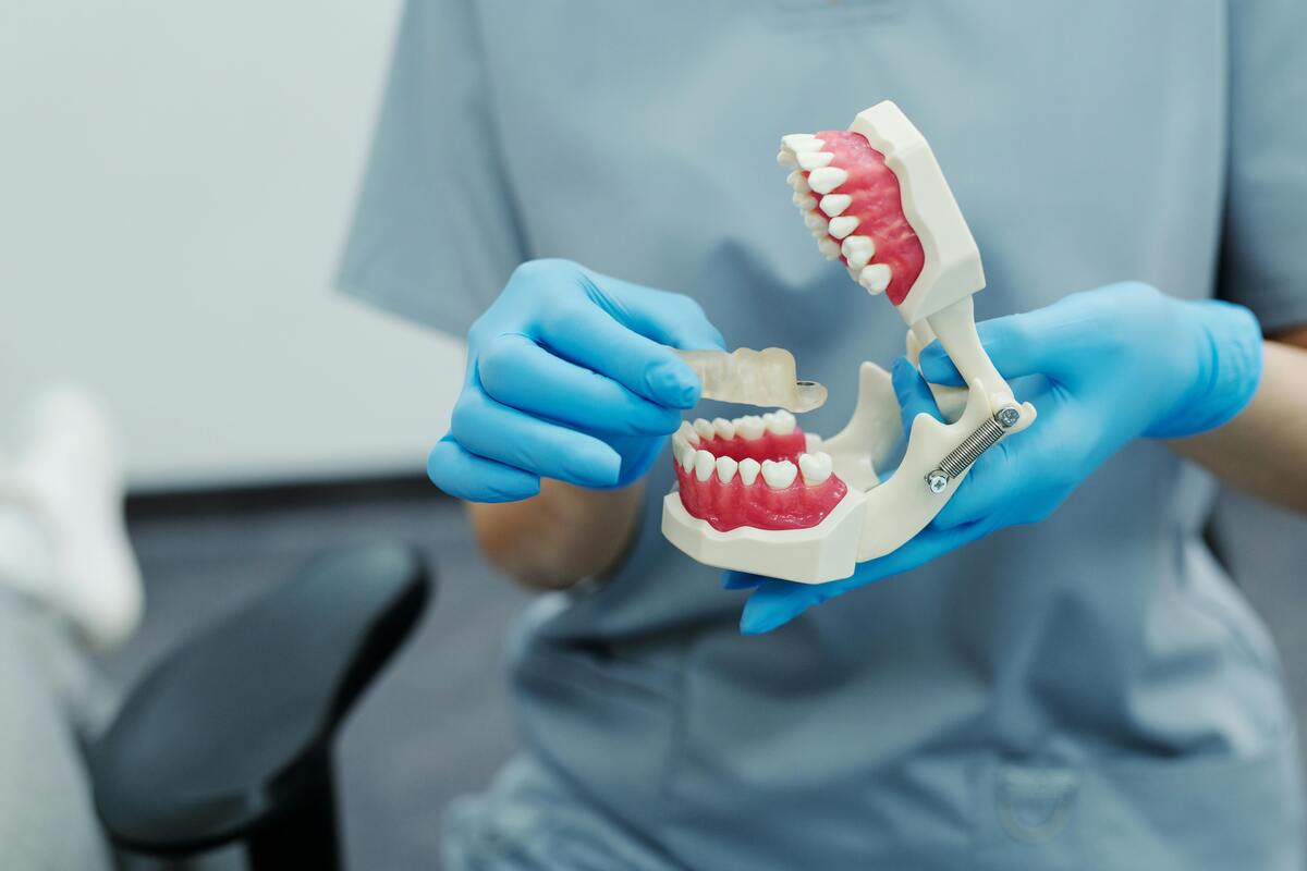 Is Professional Teeth Whitening Worth It ?